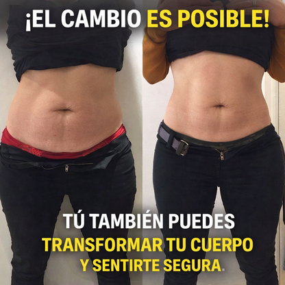 Gummies Vinagre de Manzana